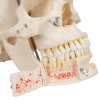 A27 06 1200 1200 Deluxe Human Demonstration Dental Skull Model 10 part 3B Smart Anatomy