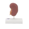 K29 04 1200 1200 Kidney Stone Model 3B Smart Anatomy