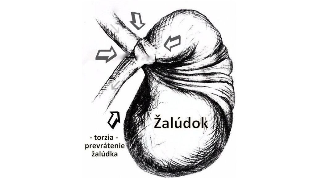 Torzia žalúdka