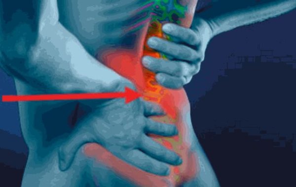 CBD na bolesť chrbta a degeneratívne ochorenie platničiek