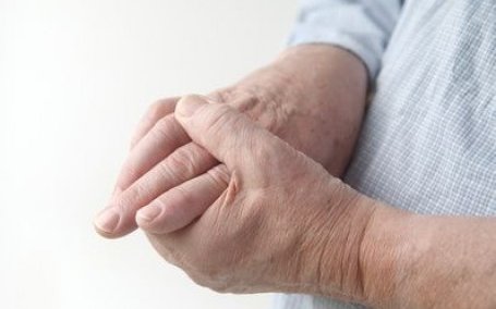 CBD na artritídu