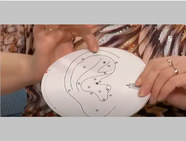 Nemoci kůže TV Pětka, Na vrcholu 22. díl