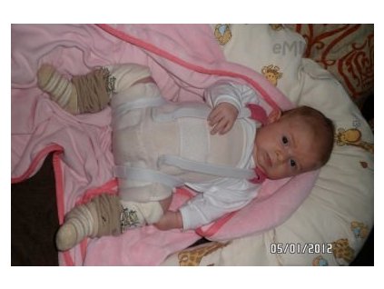 Peřinka abdukční FREJK (Velikost 14)