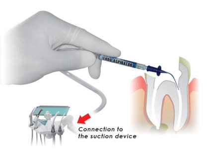 Cerkamed - Endo Aspirator